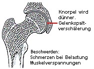 arthrosestat1.jpg