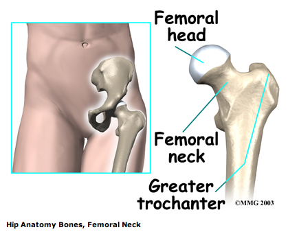 femoral_neck.png